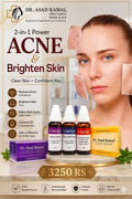 ACNE + WHITENING TREATMENT - Fairness & Acne Control Cream: 2-in-1 Whitening & Blemish Treatment | Steroid-Free
